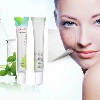 BEST Quality Oil Control Acne Treatment Best Pimples Removal Face Acne Treatment Cream